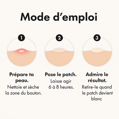 Patch anti-acné hydrocolloïde – 144 unités